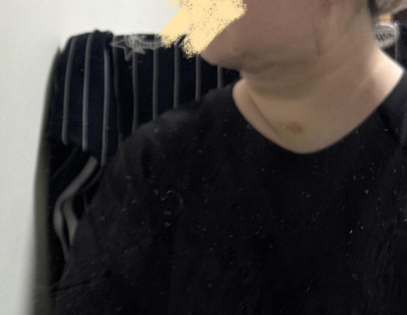 後
