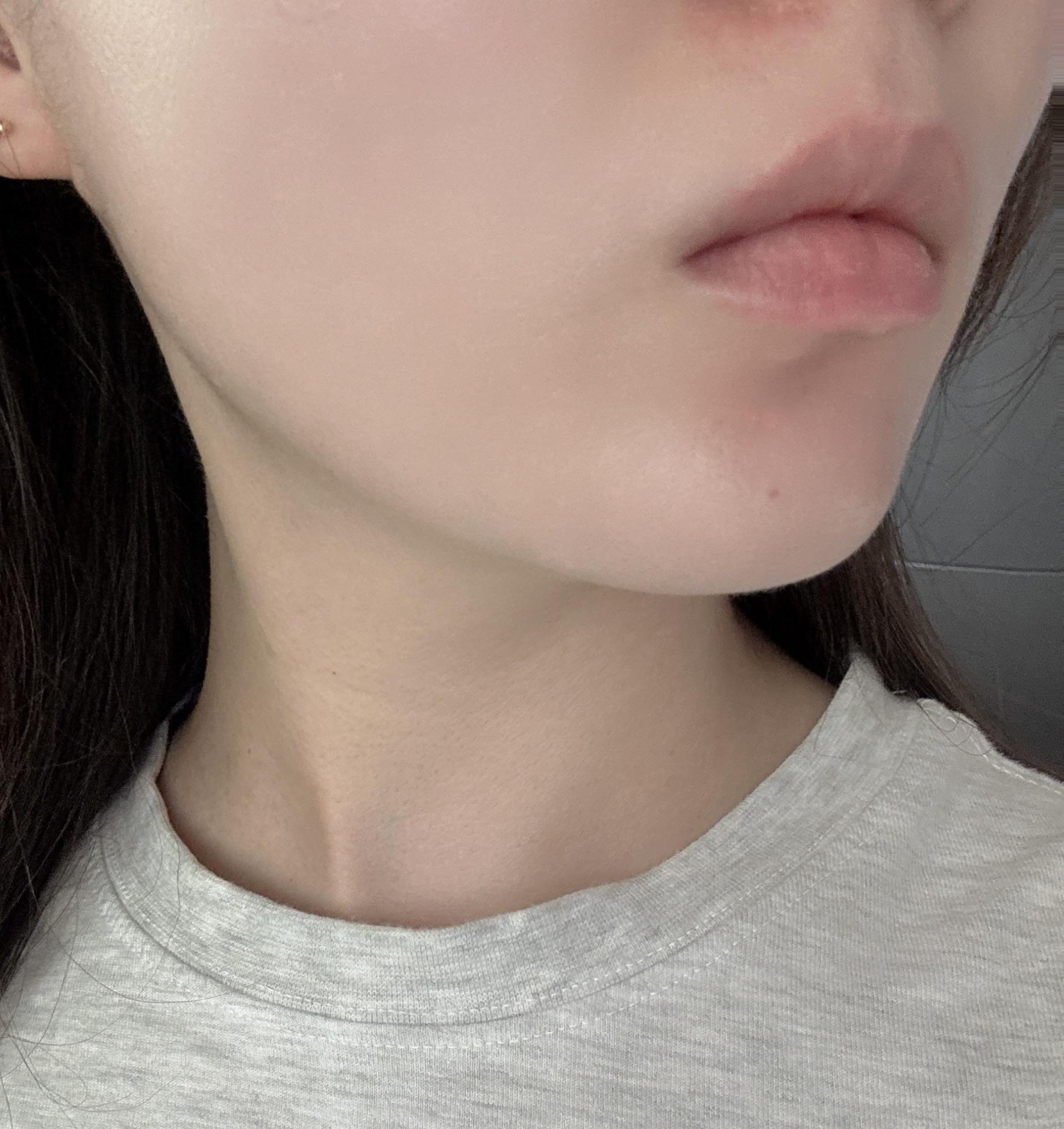 後