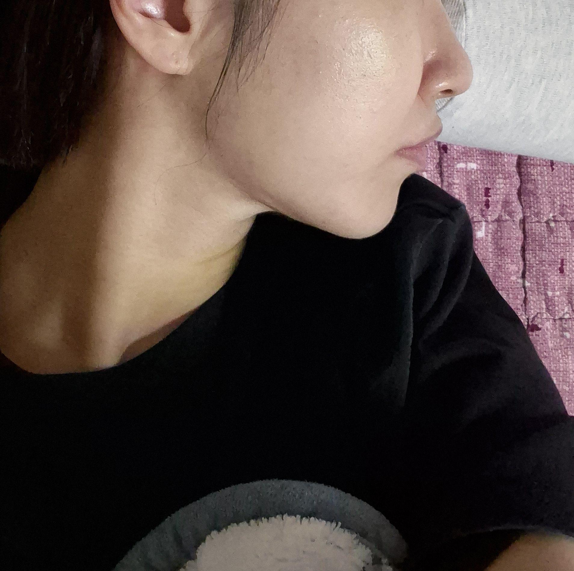 后