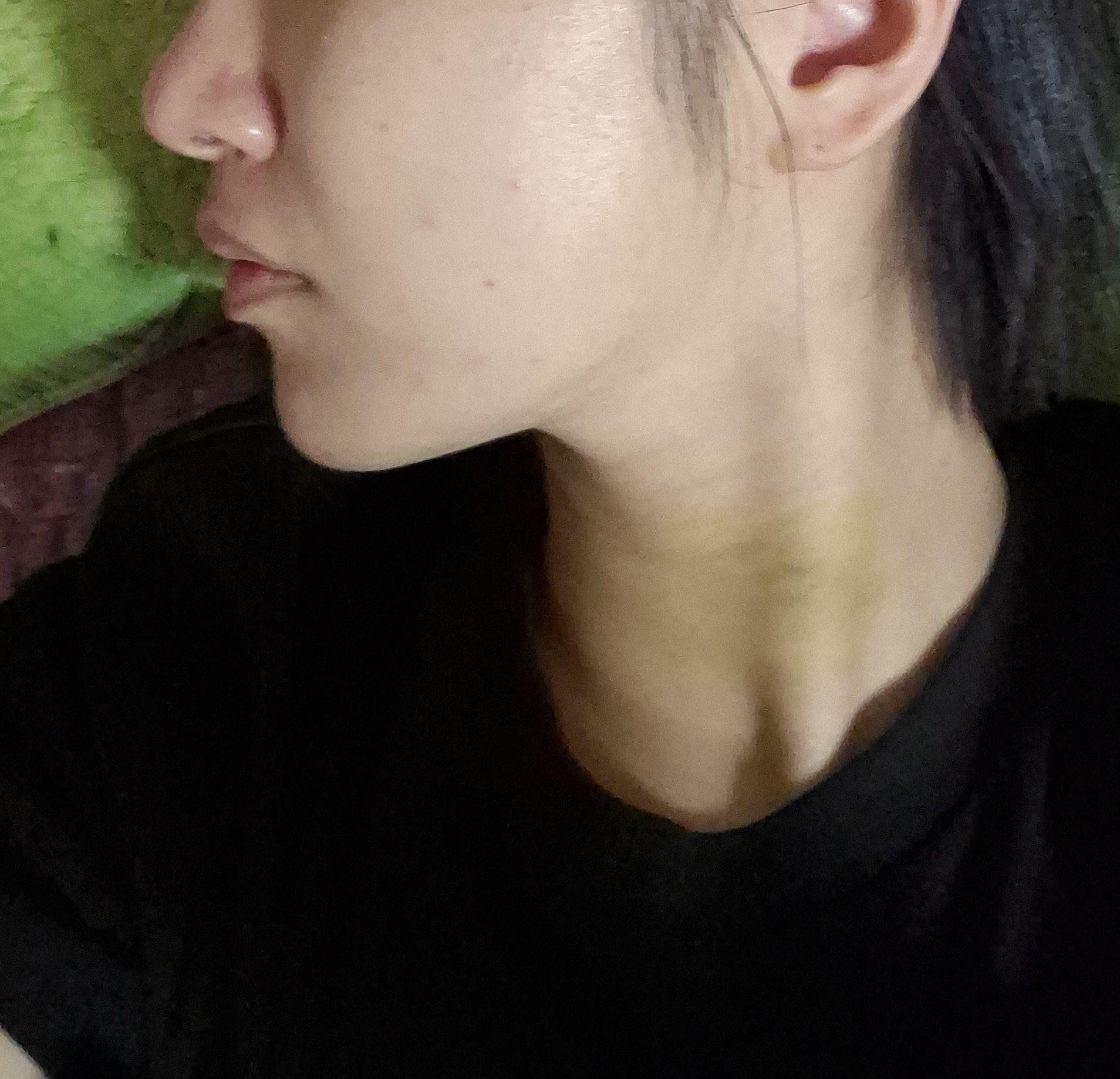 后