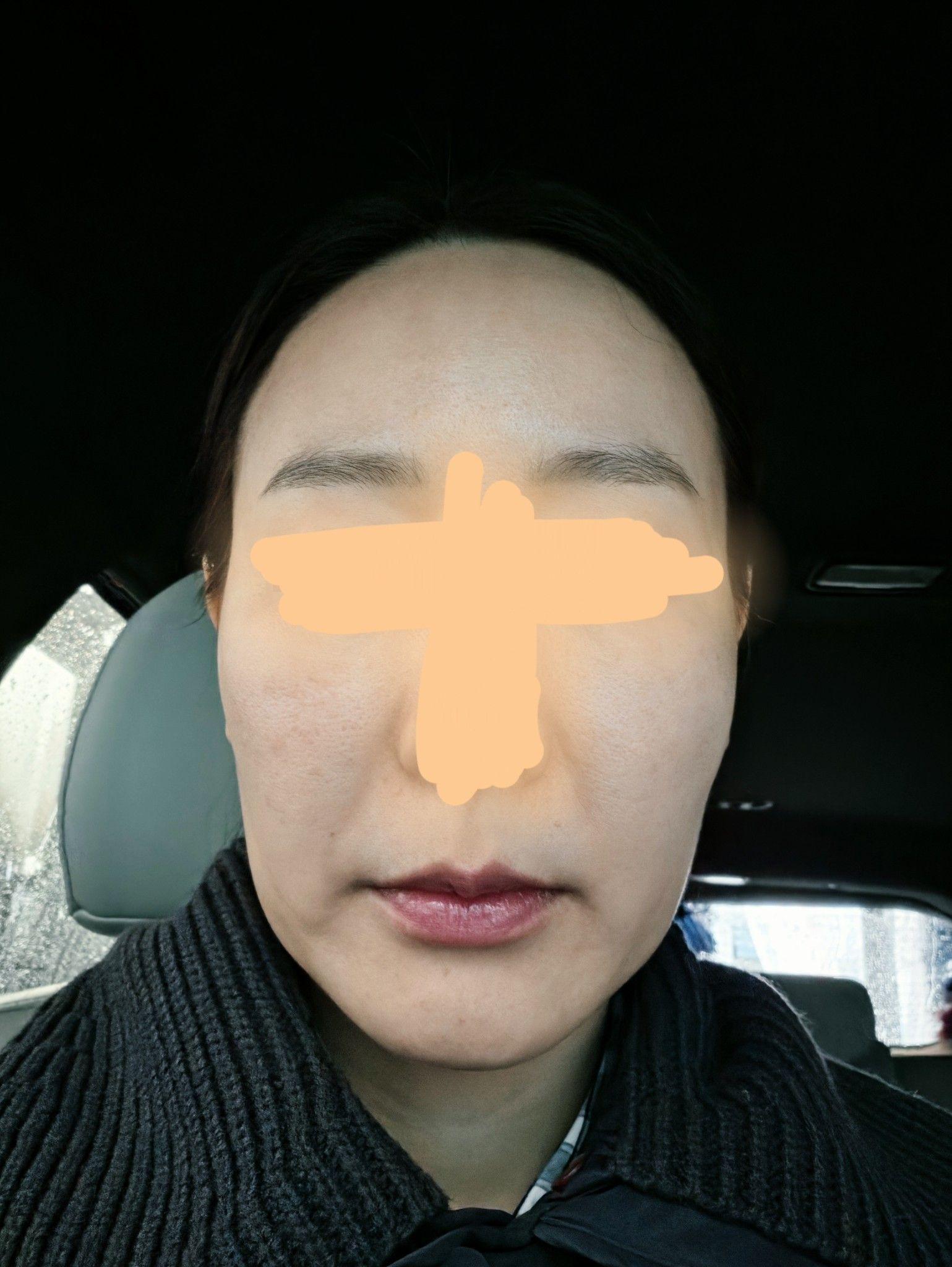 後
