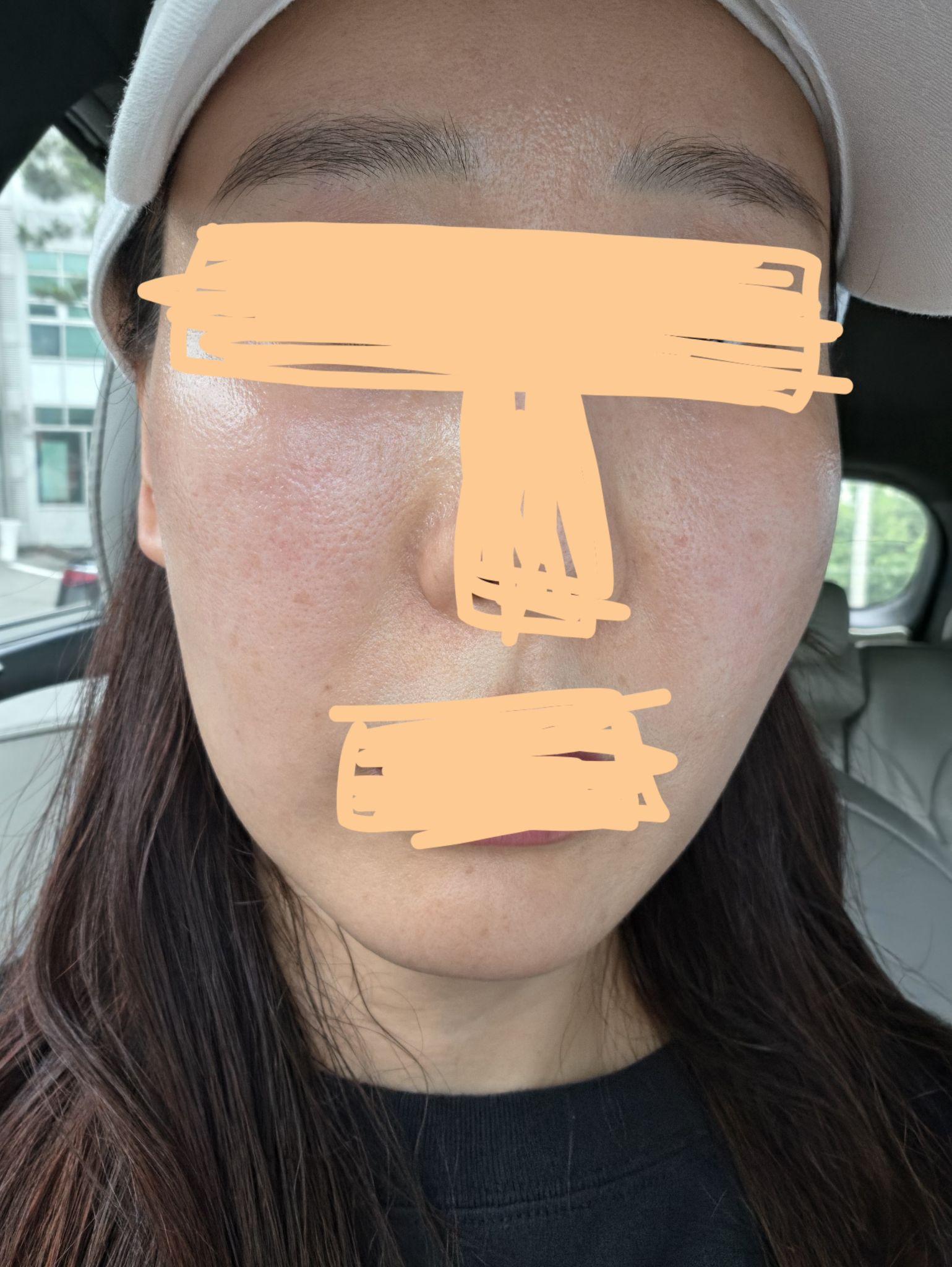 後