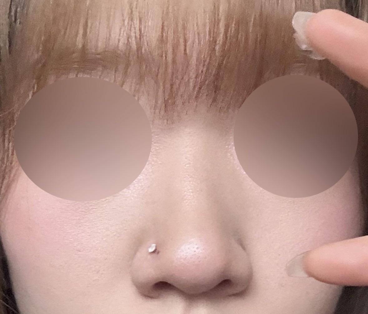 後