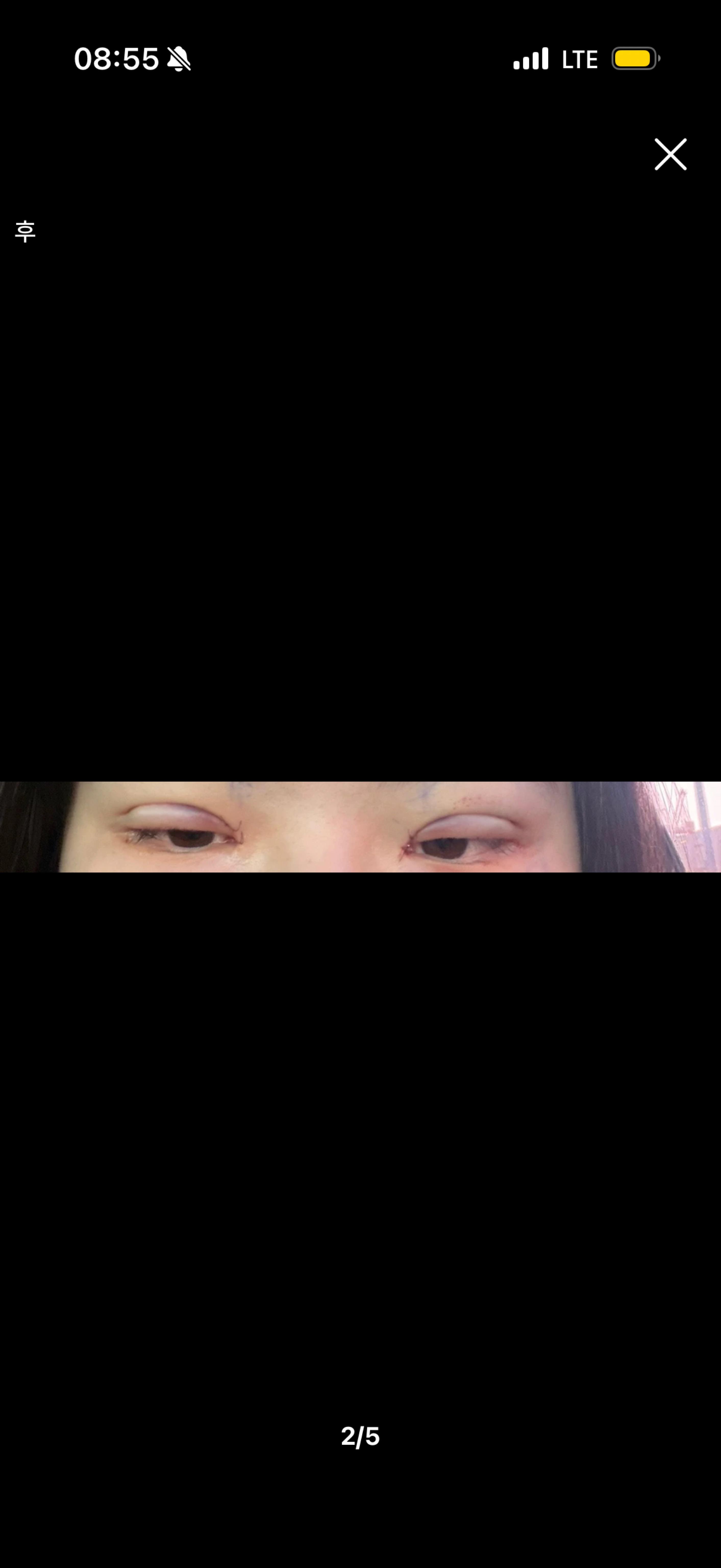 後