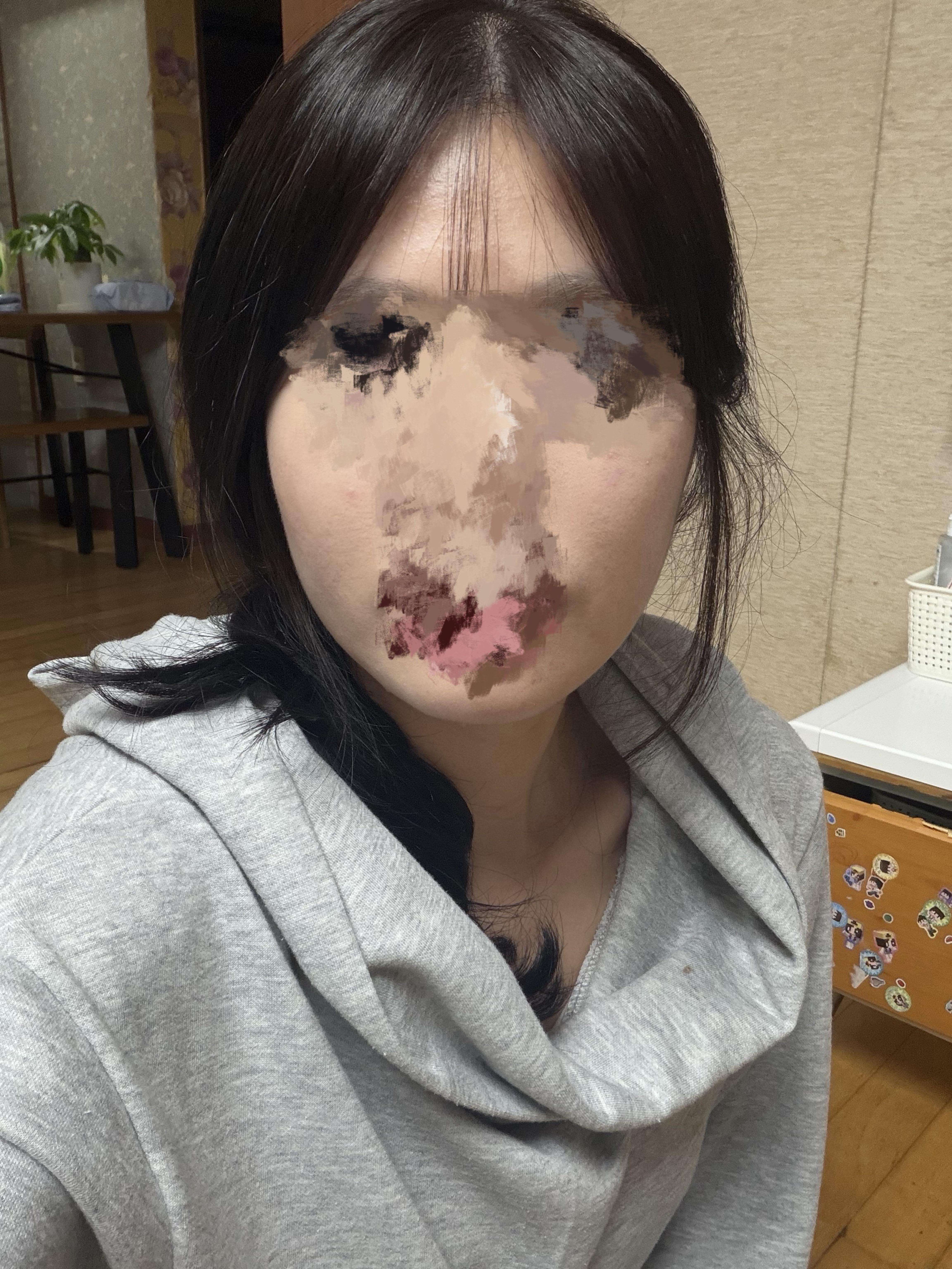 後