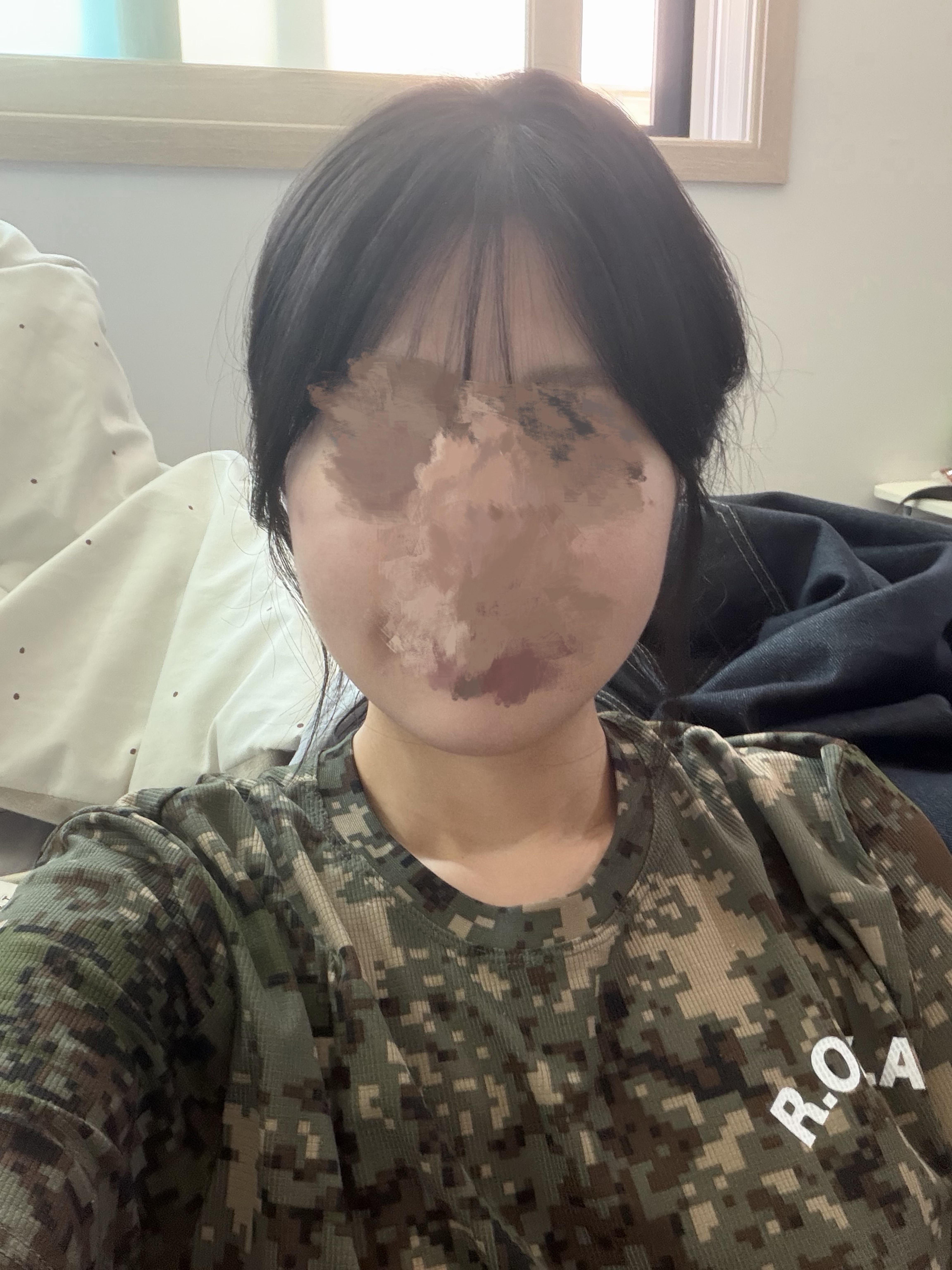 後