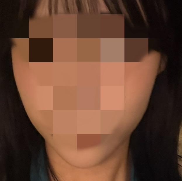 前