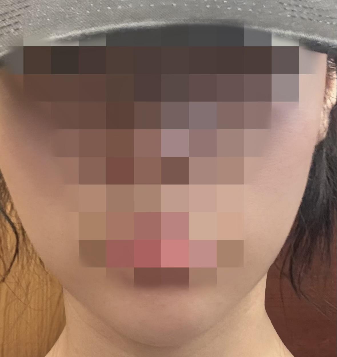 後