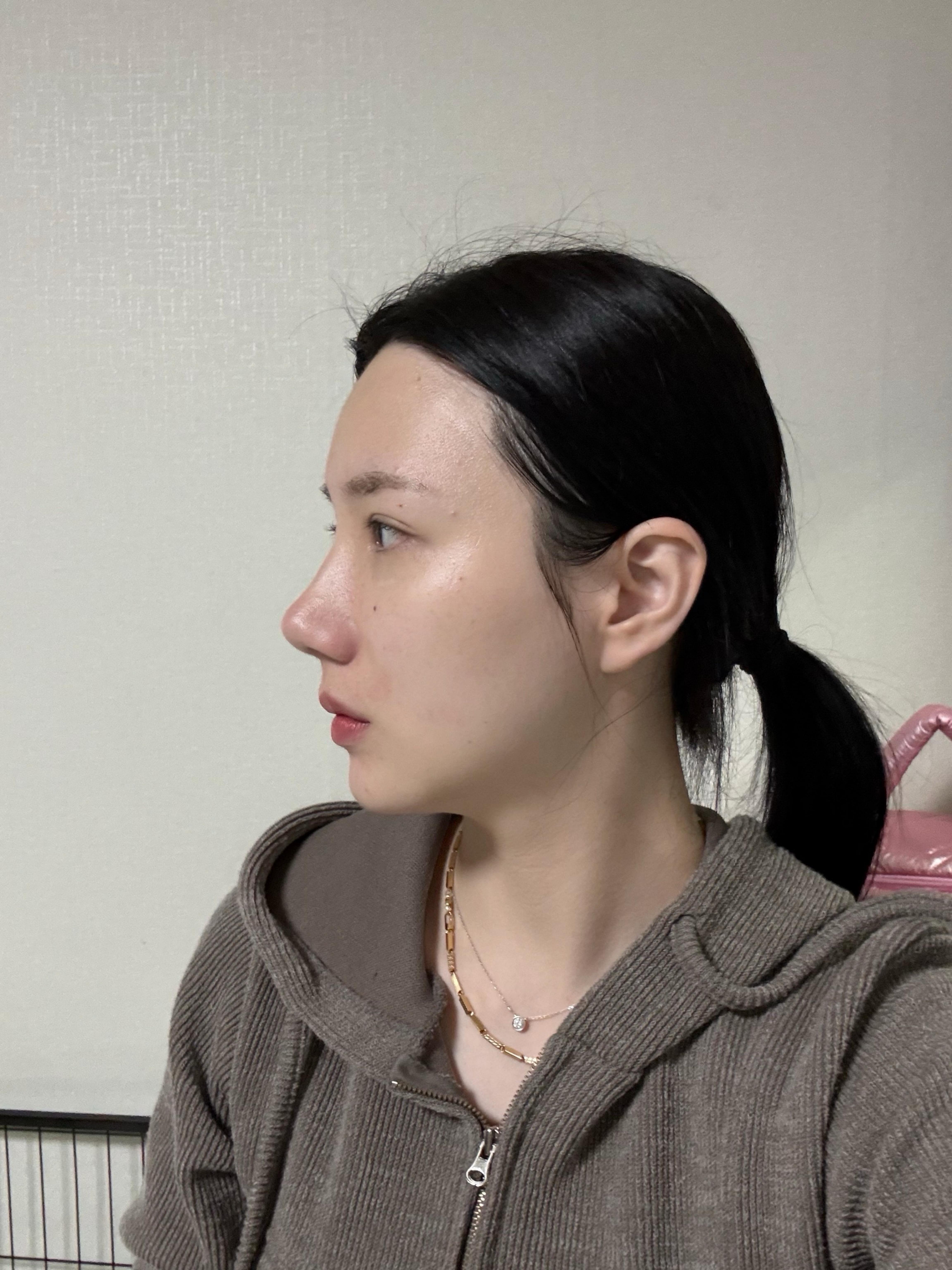 後