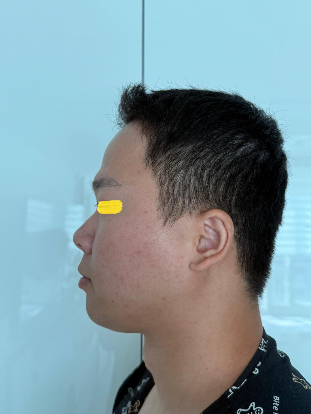 後