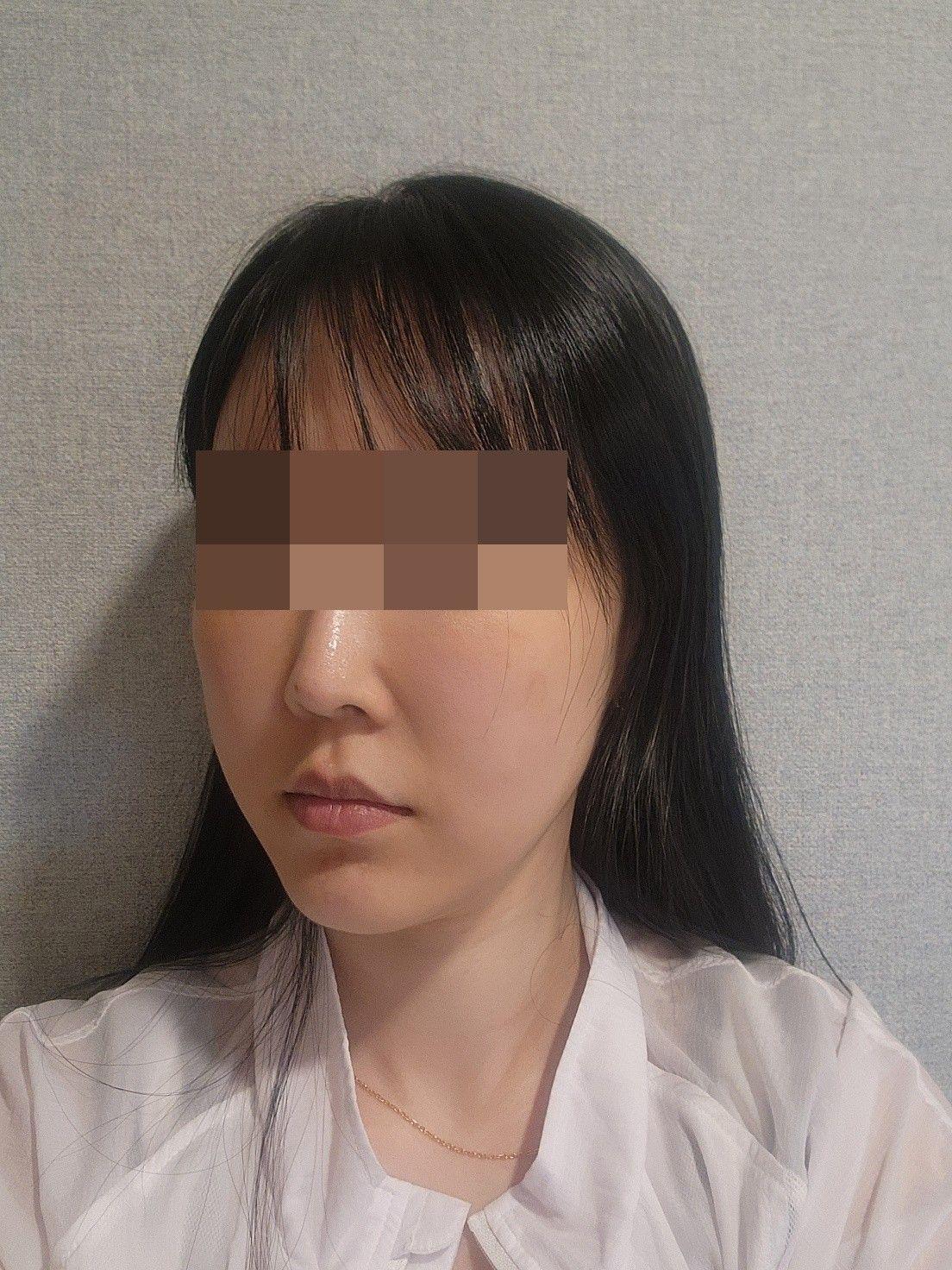 後