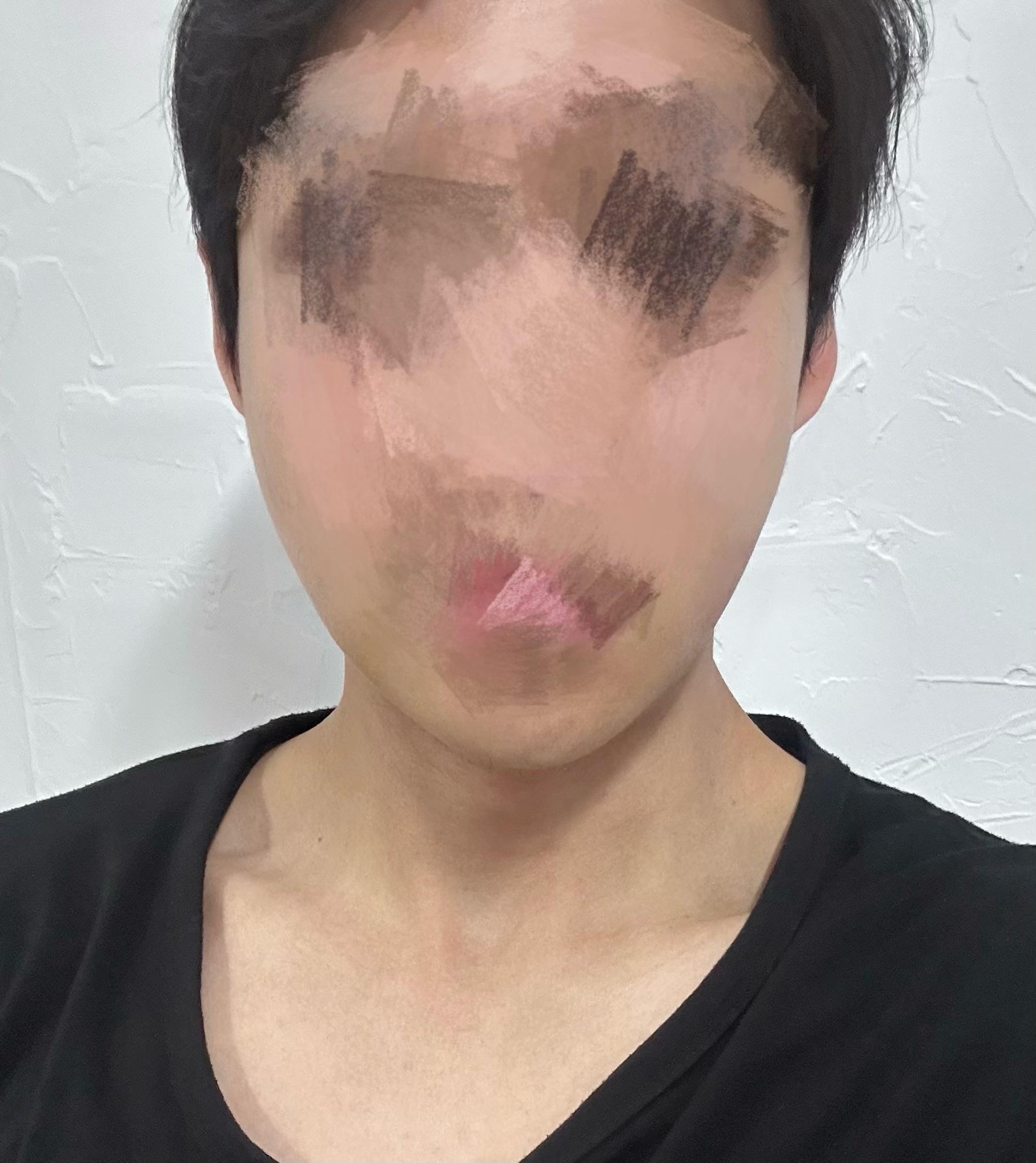 後