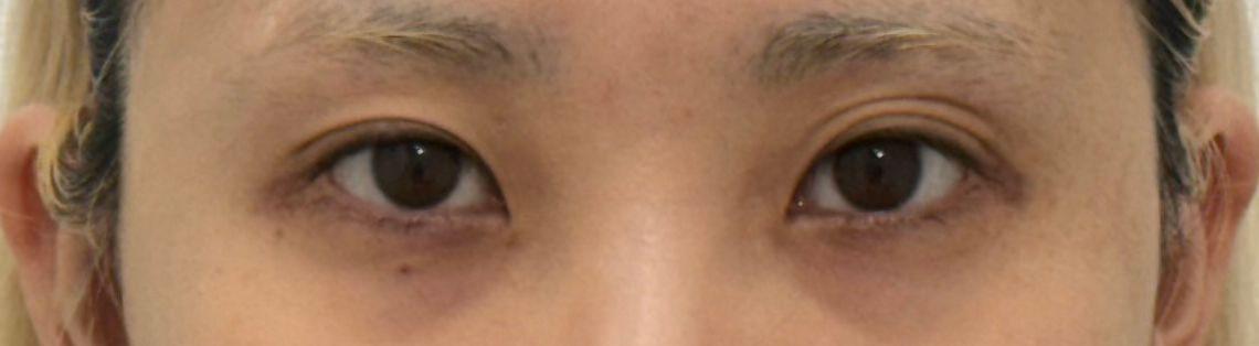 後