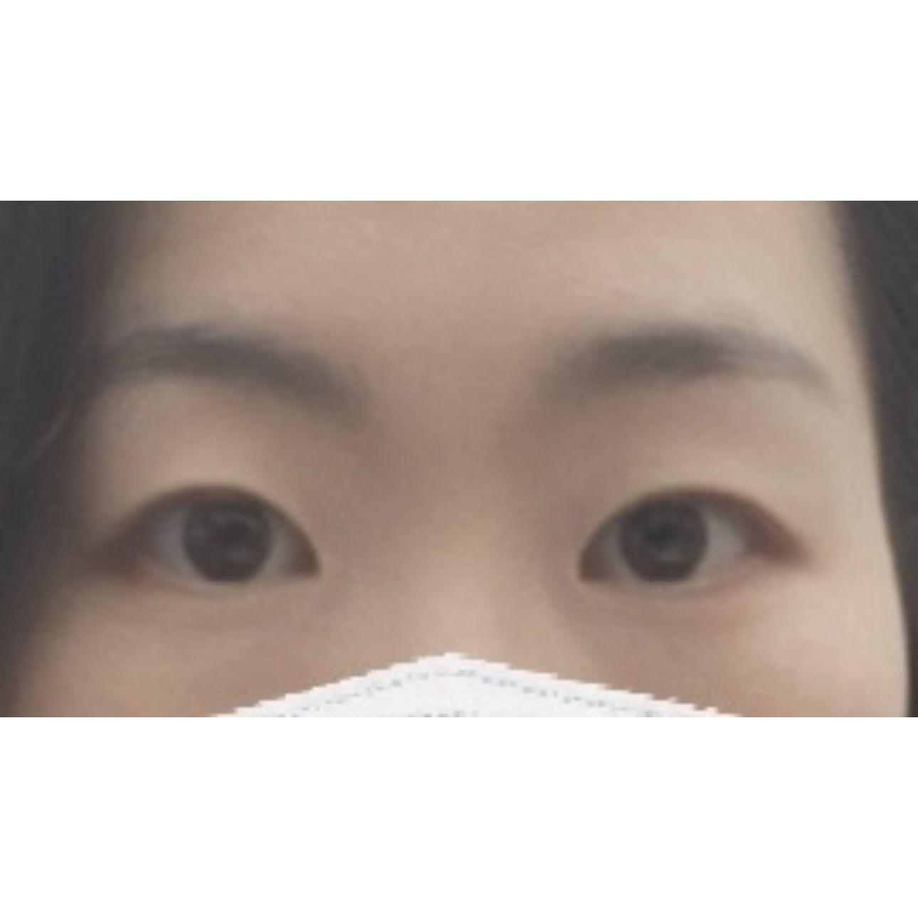 後