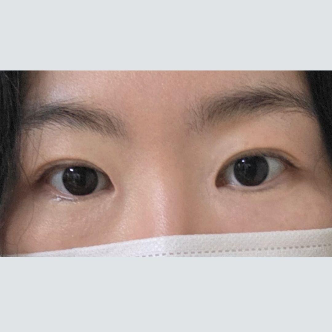 後