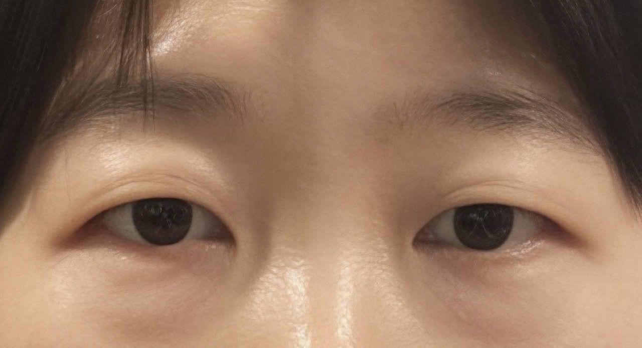 後