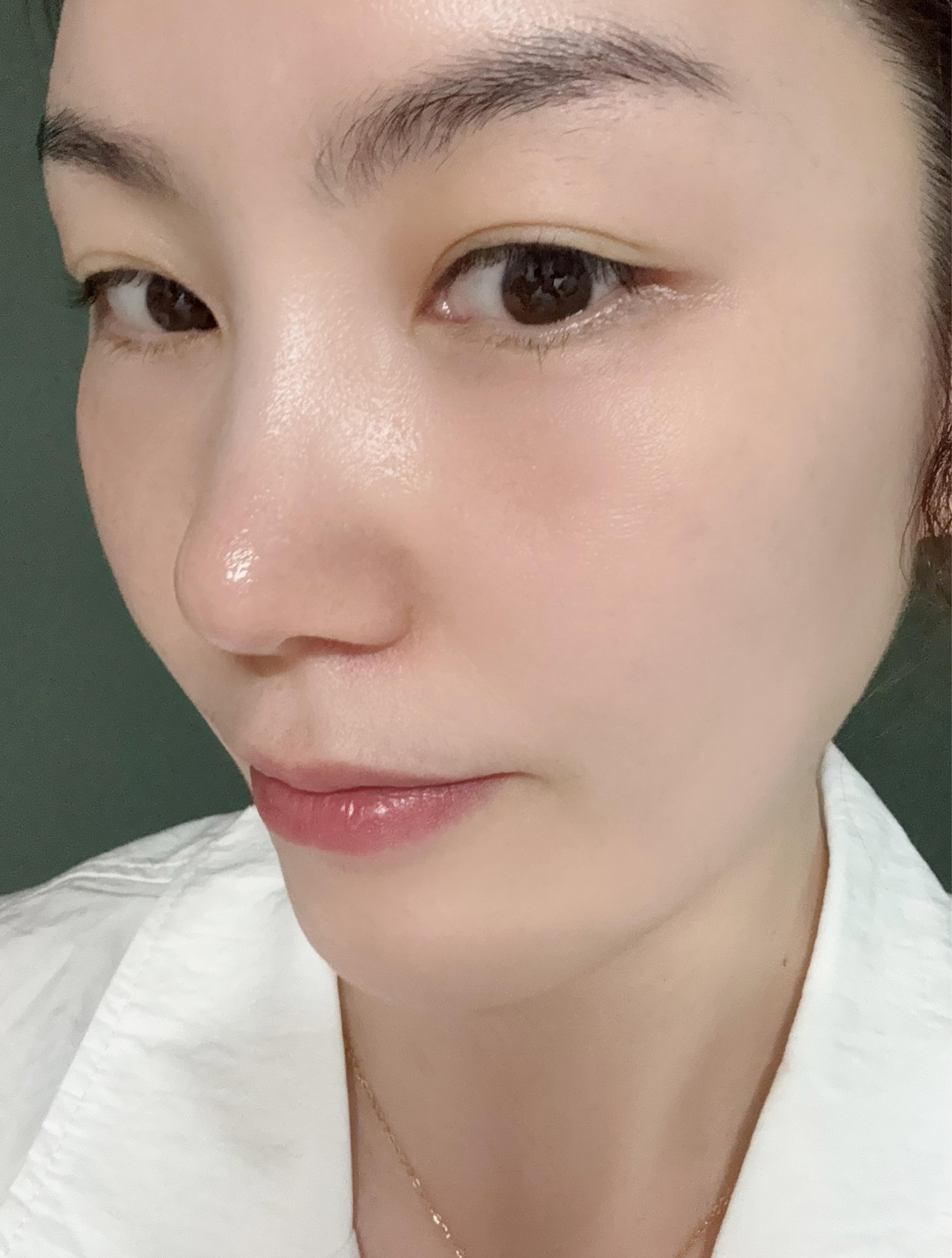 後