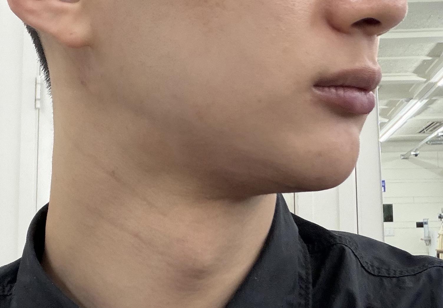 後