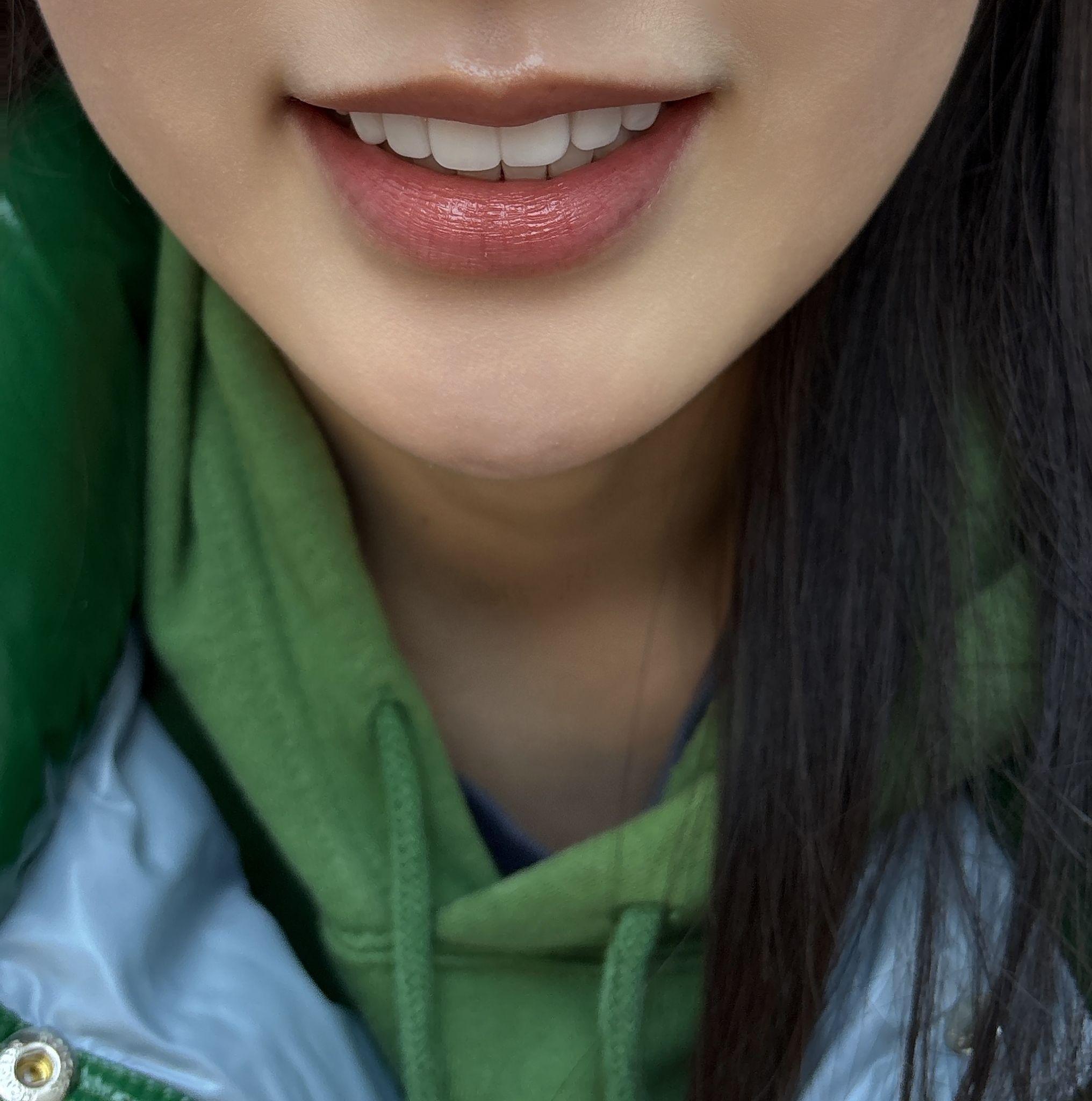 後