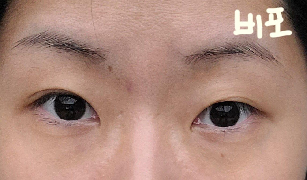 後