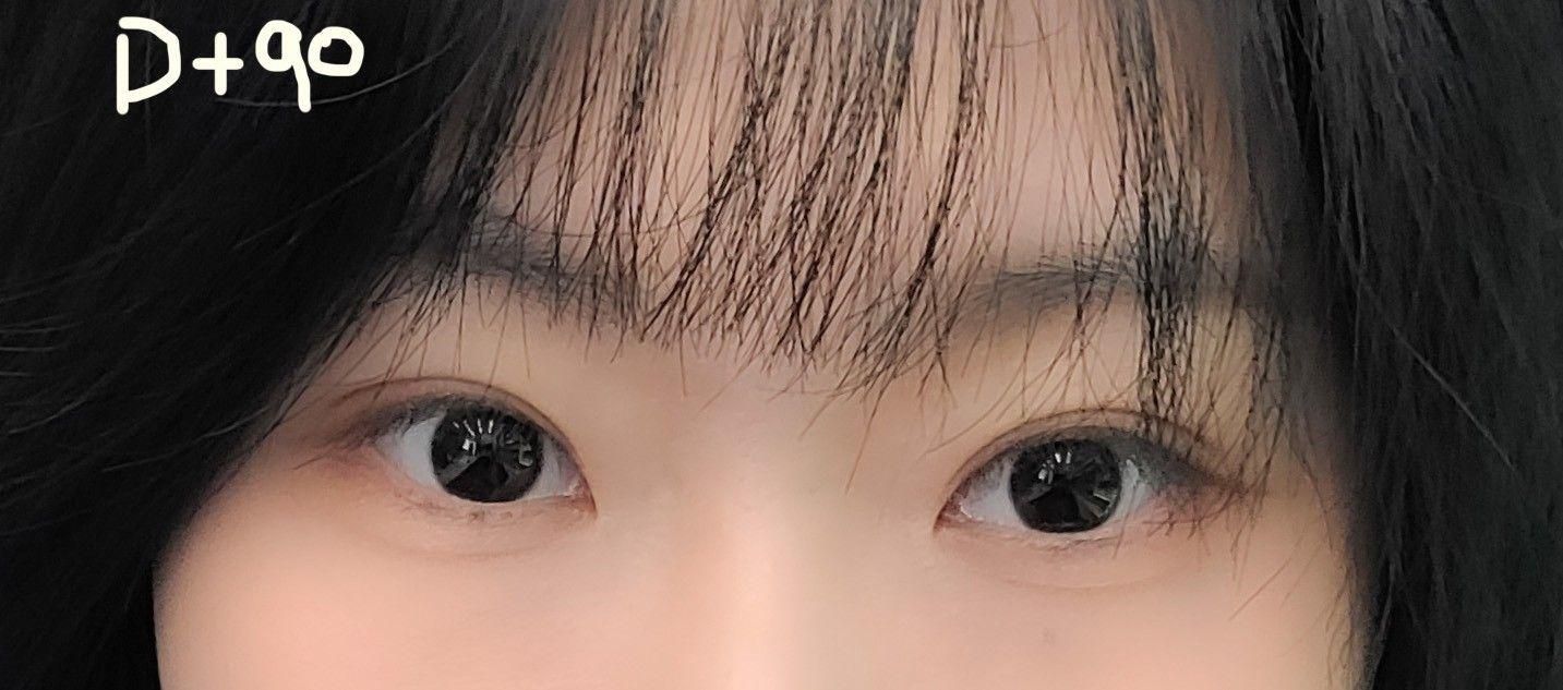 後