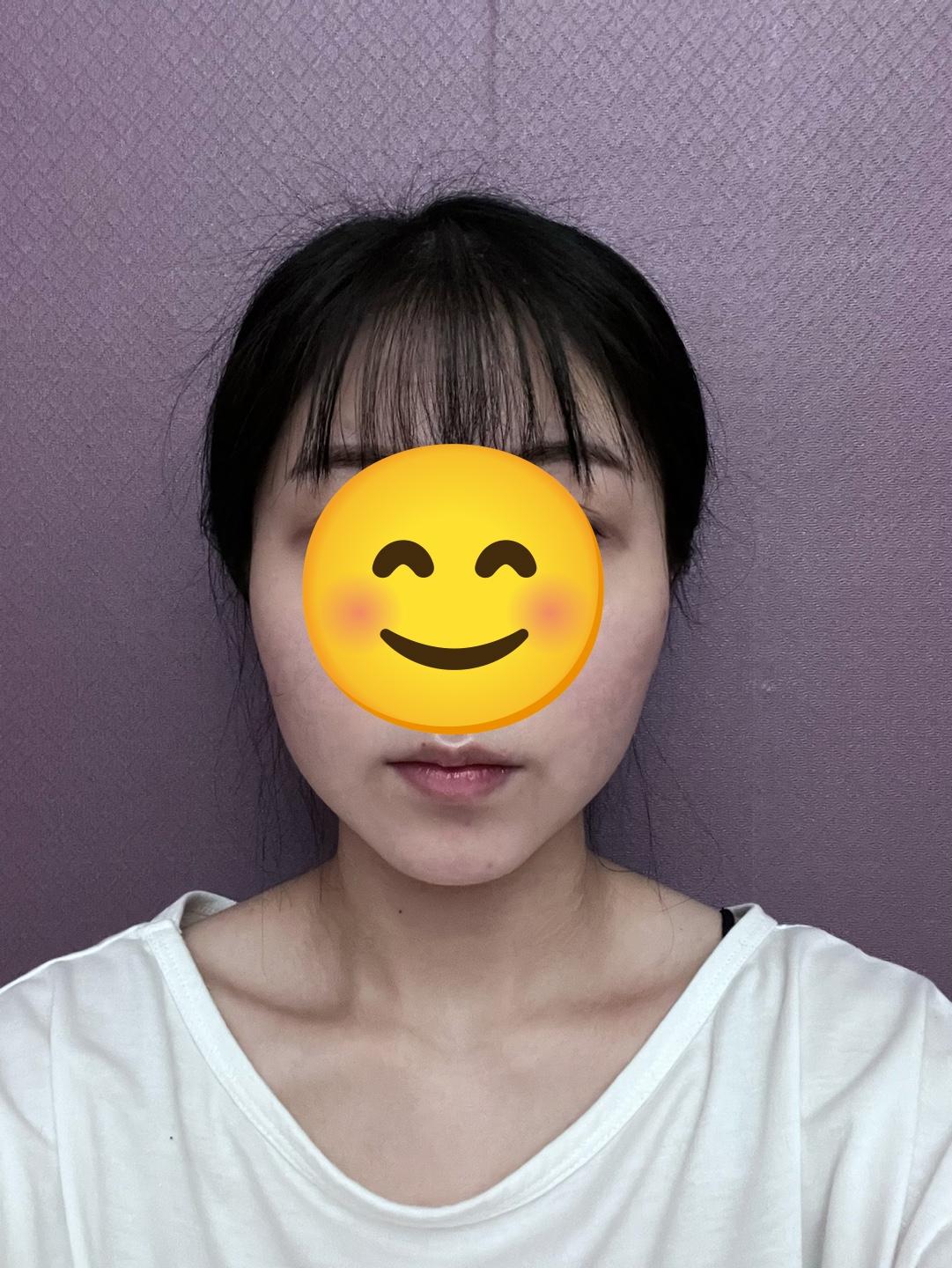 後