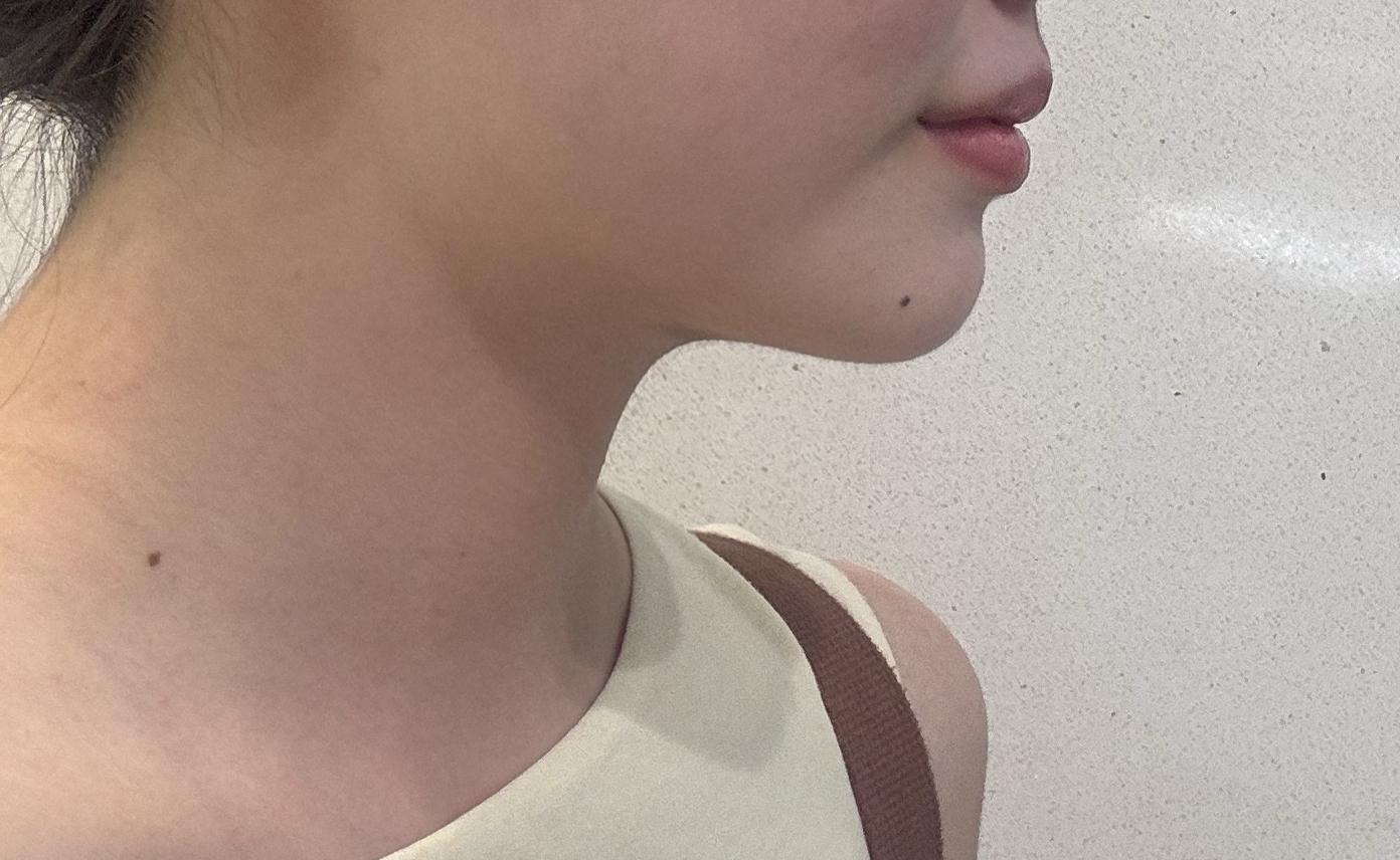後