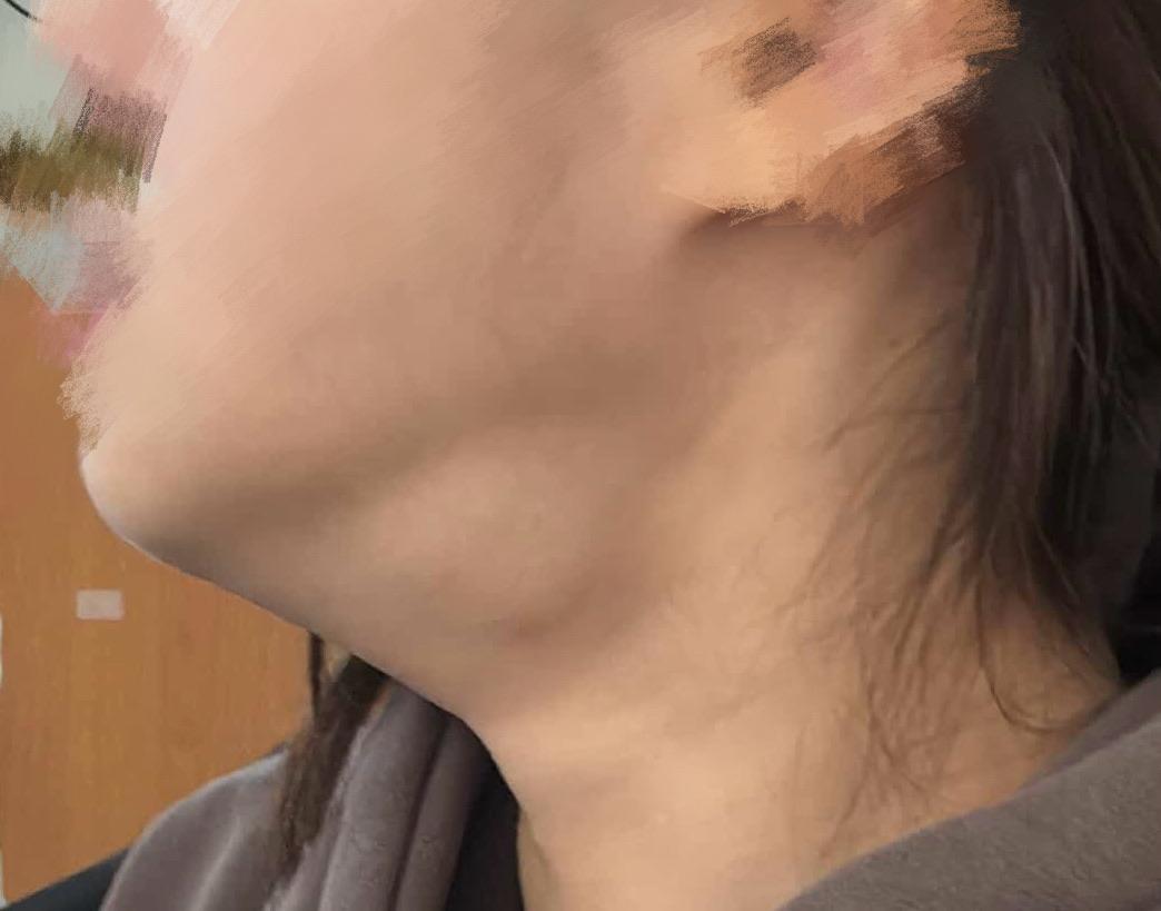 後