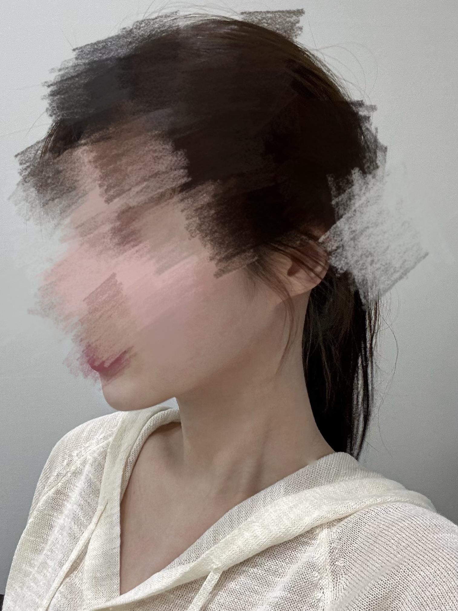 後