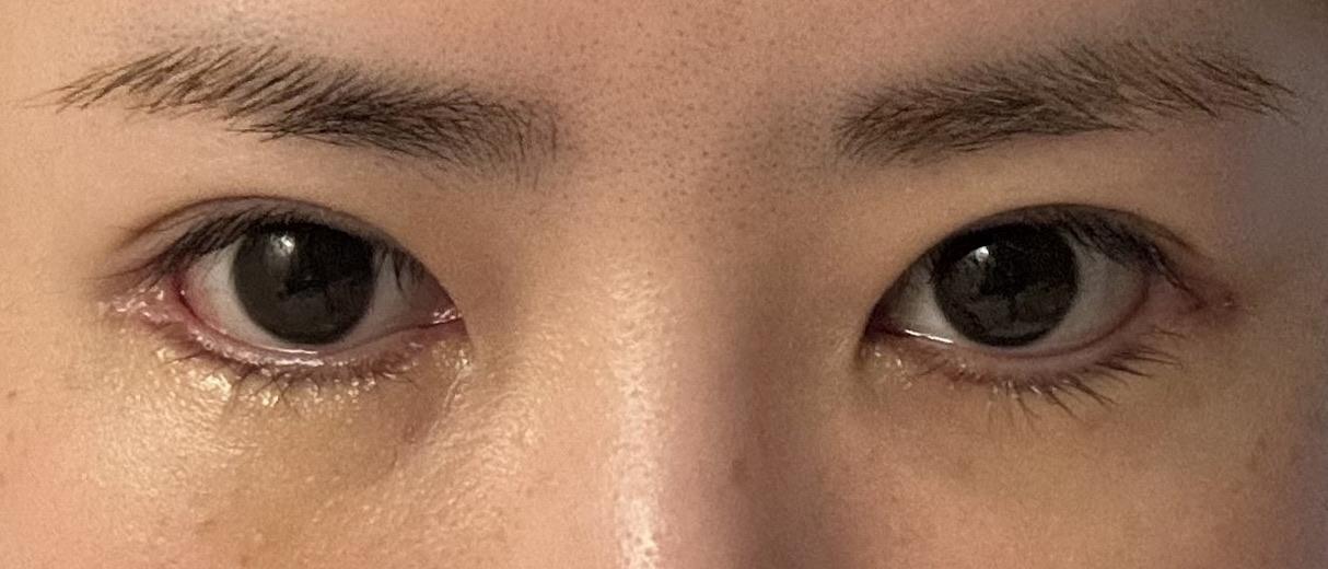 後