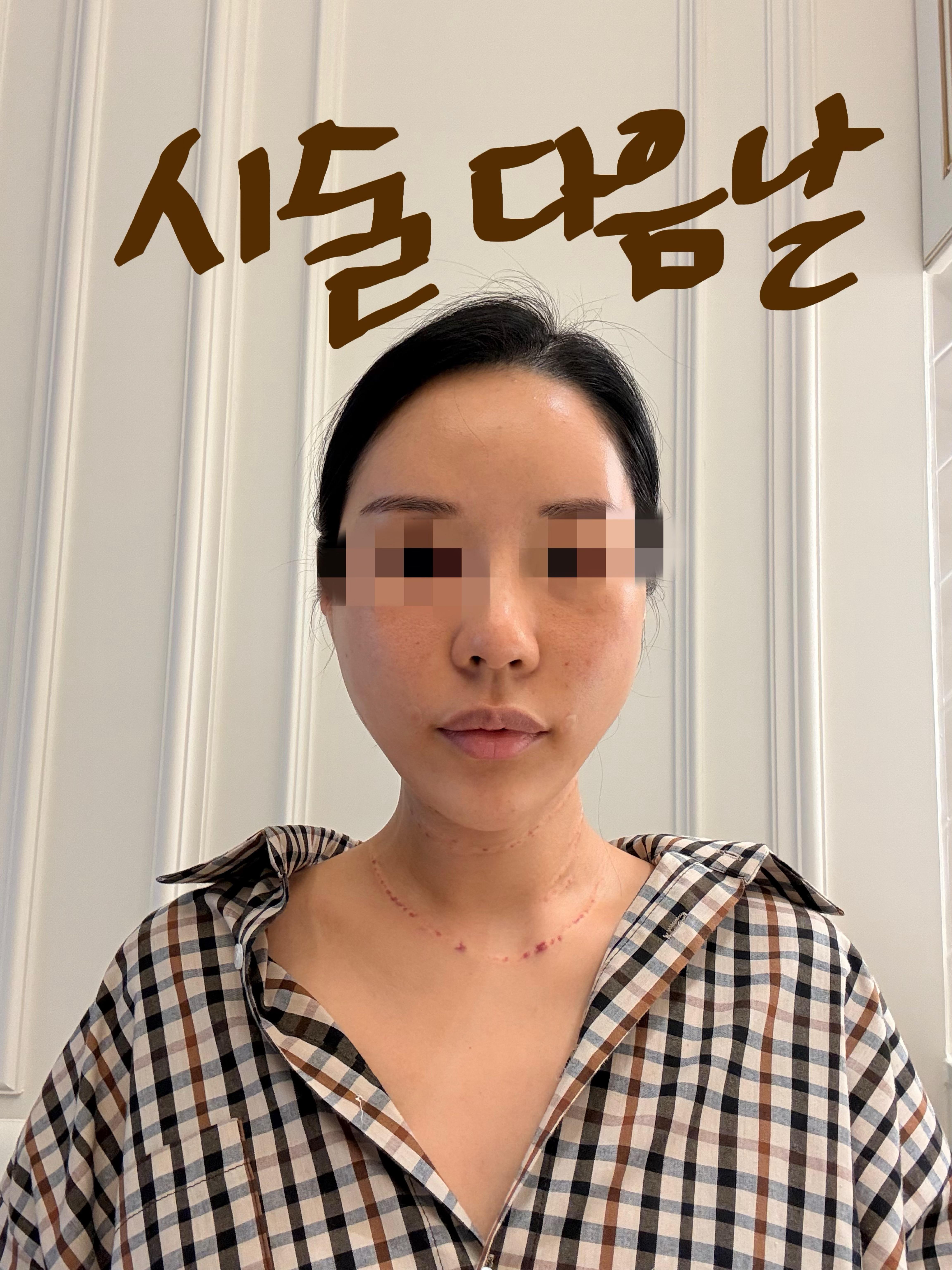 後