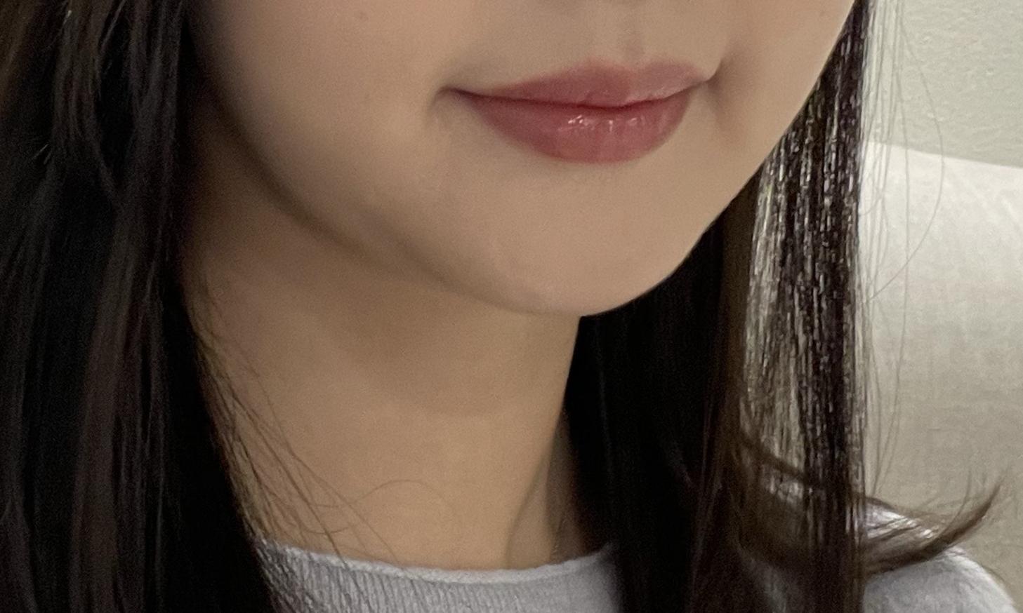 後