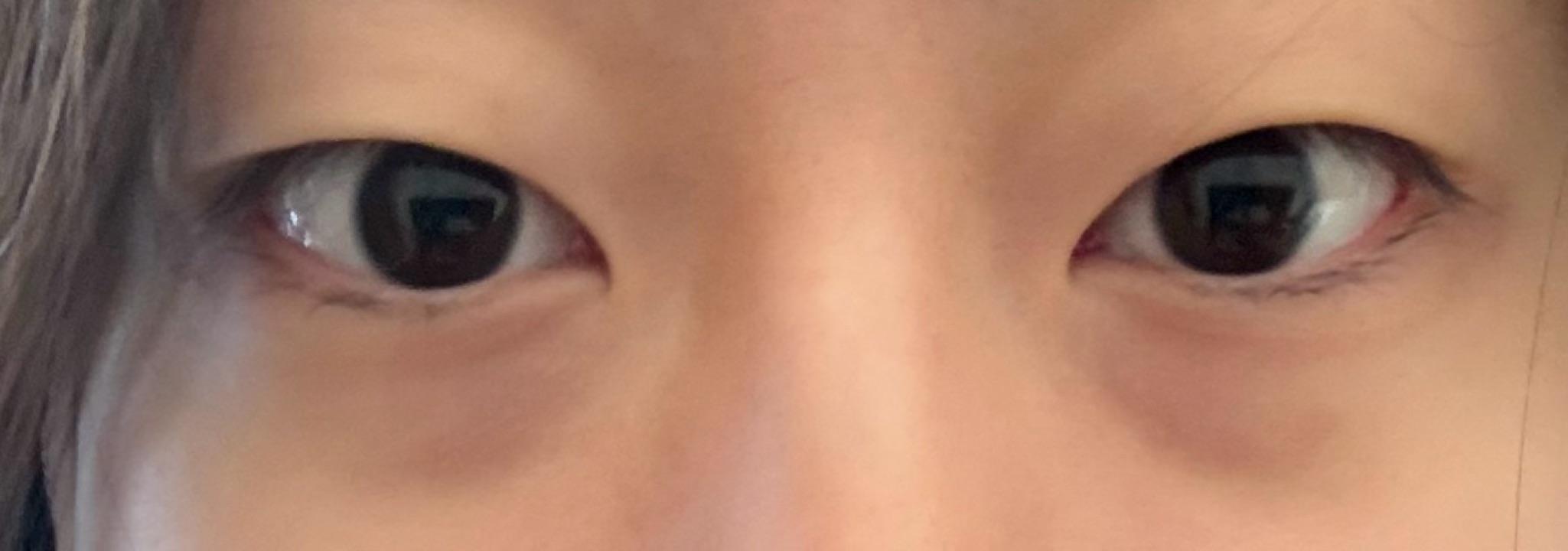 前