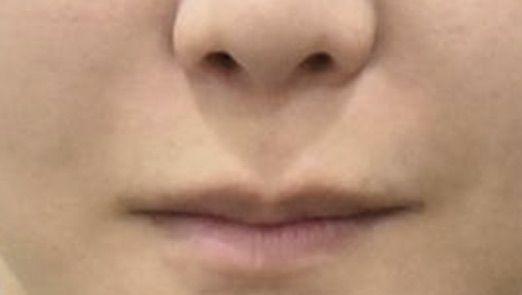 後