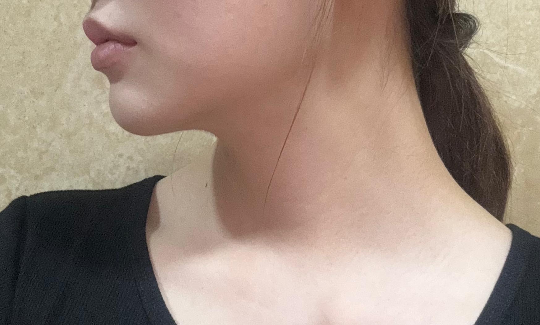 後