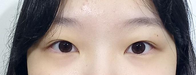 後
