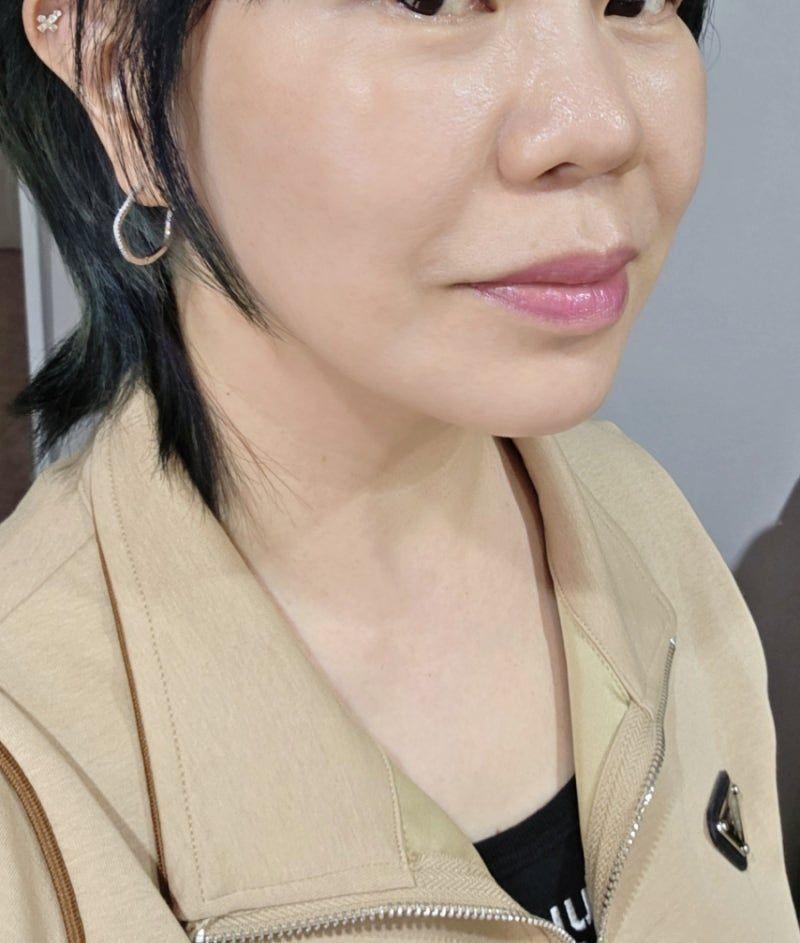 後