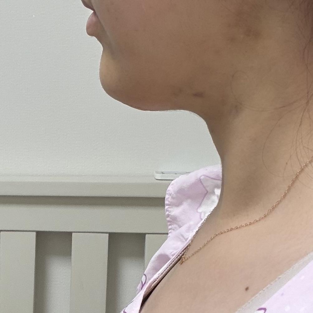 後