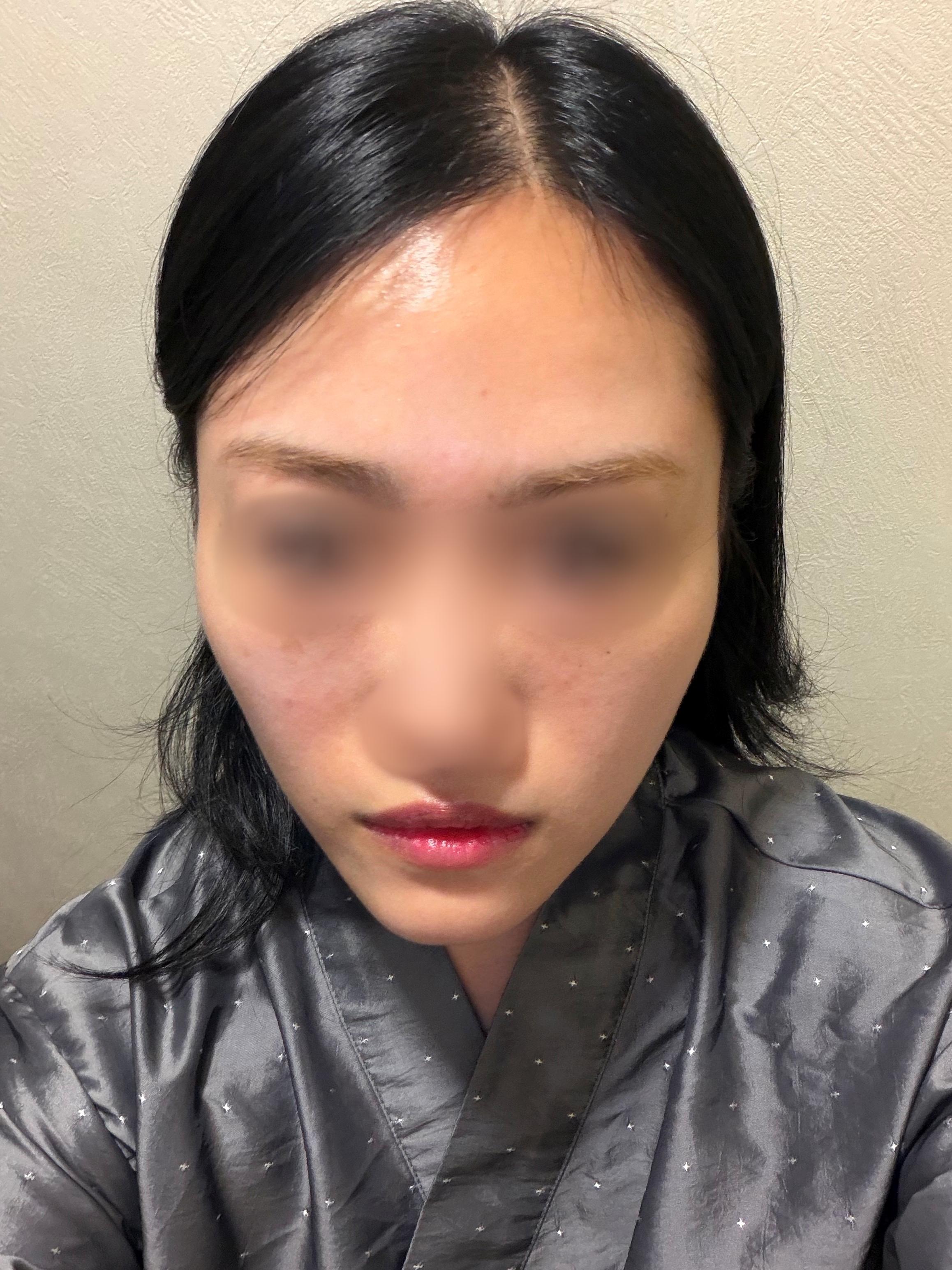 後