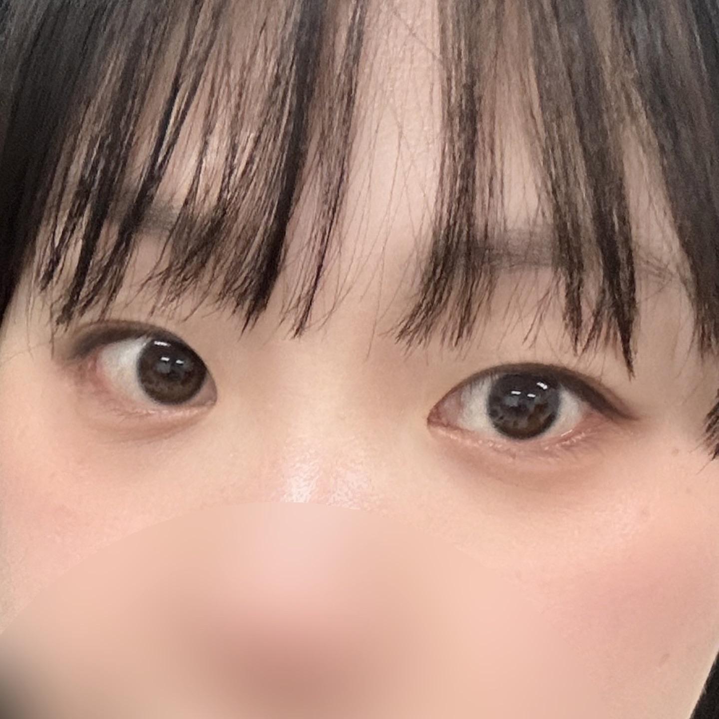 後