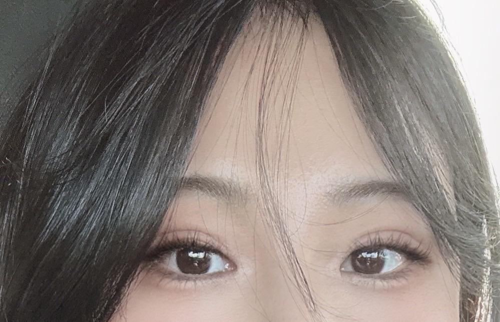 後