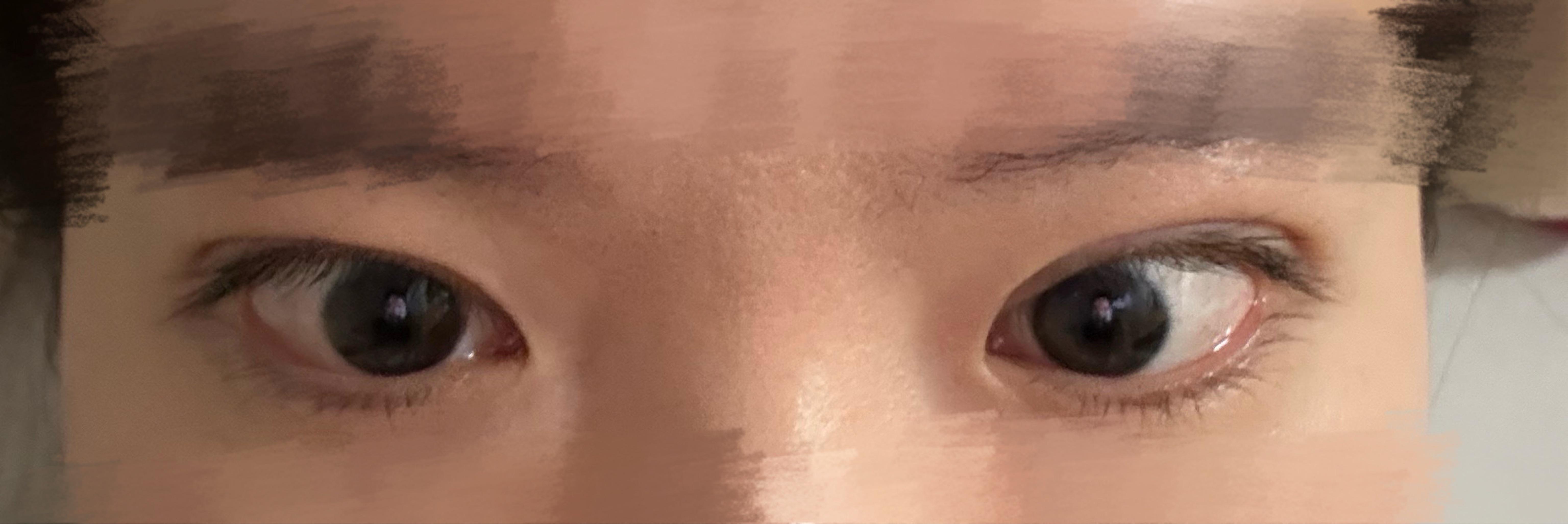 後