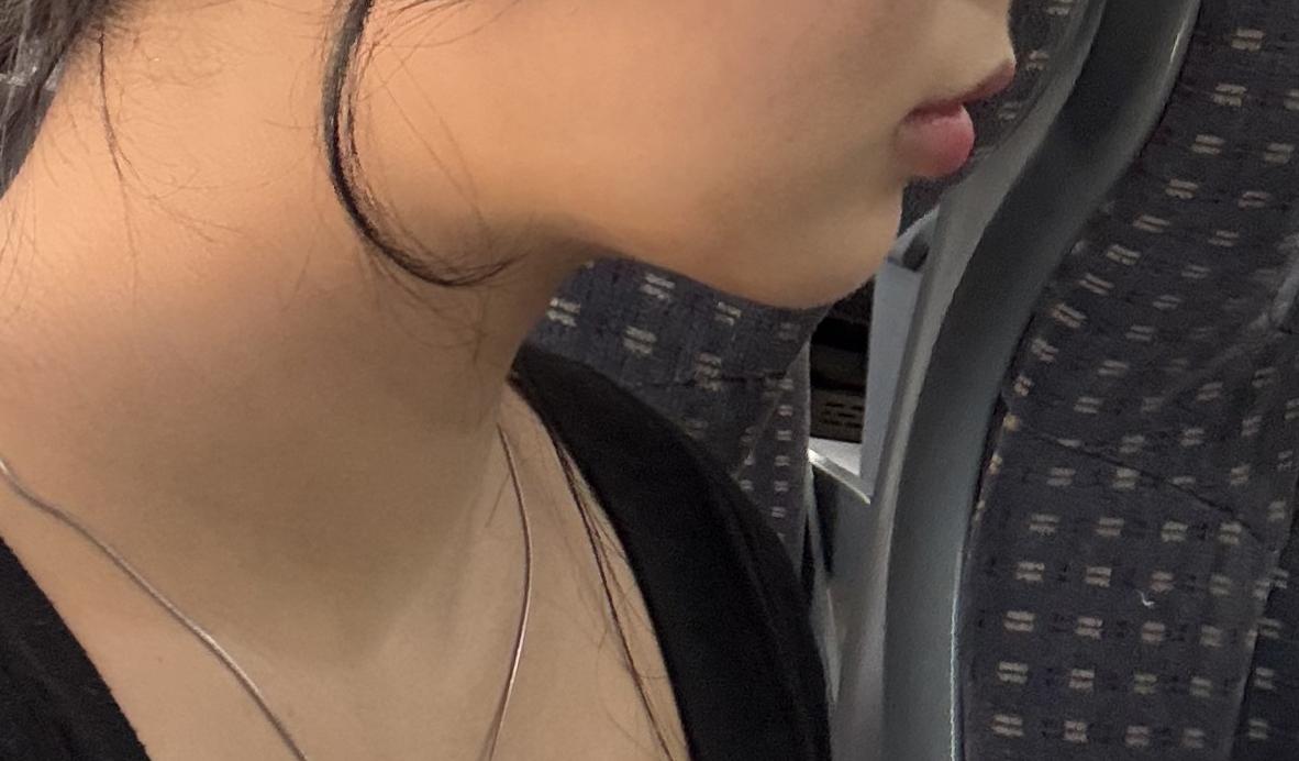 後