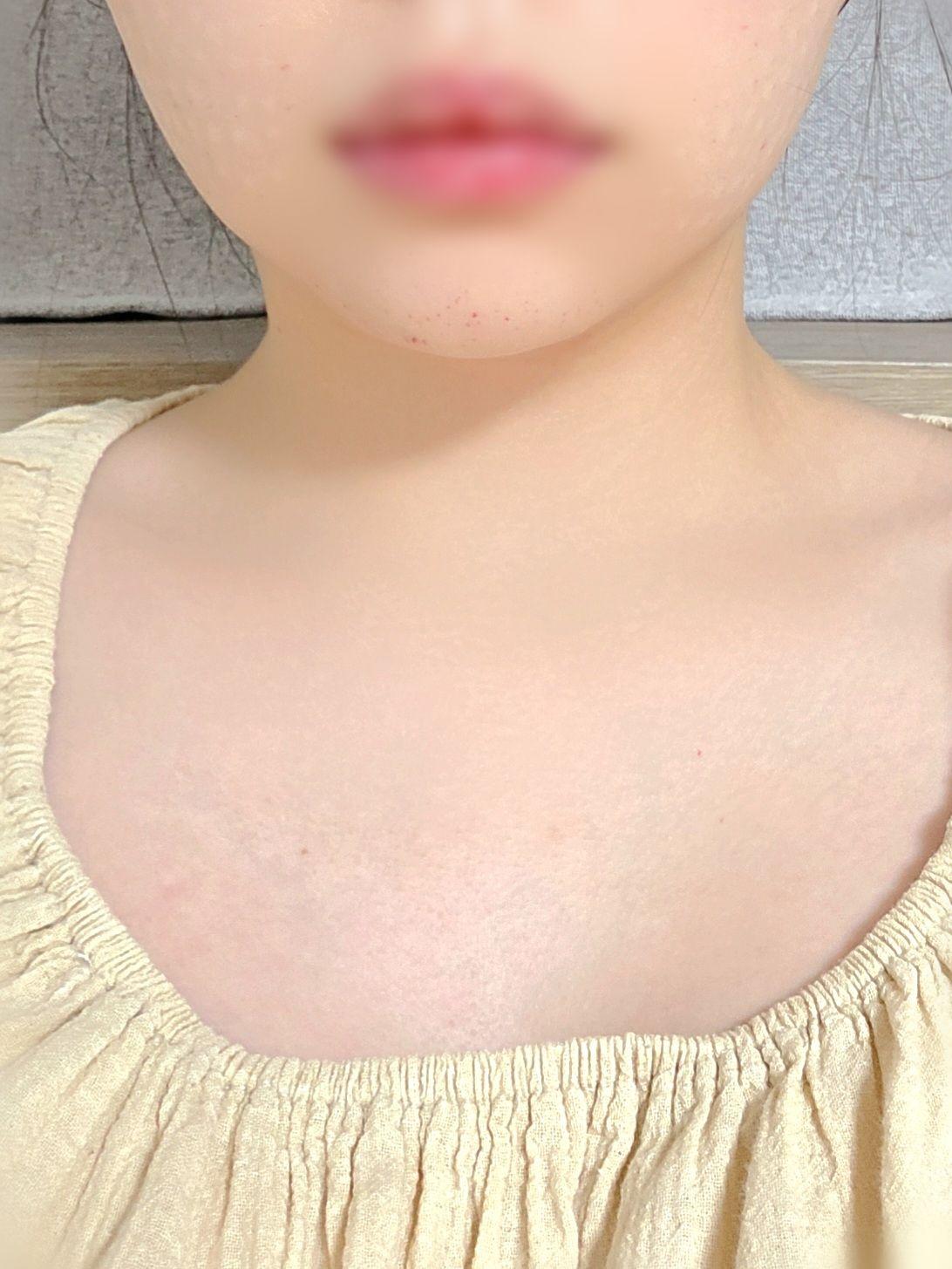 後