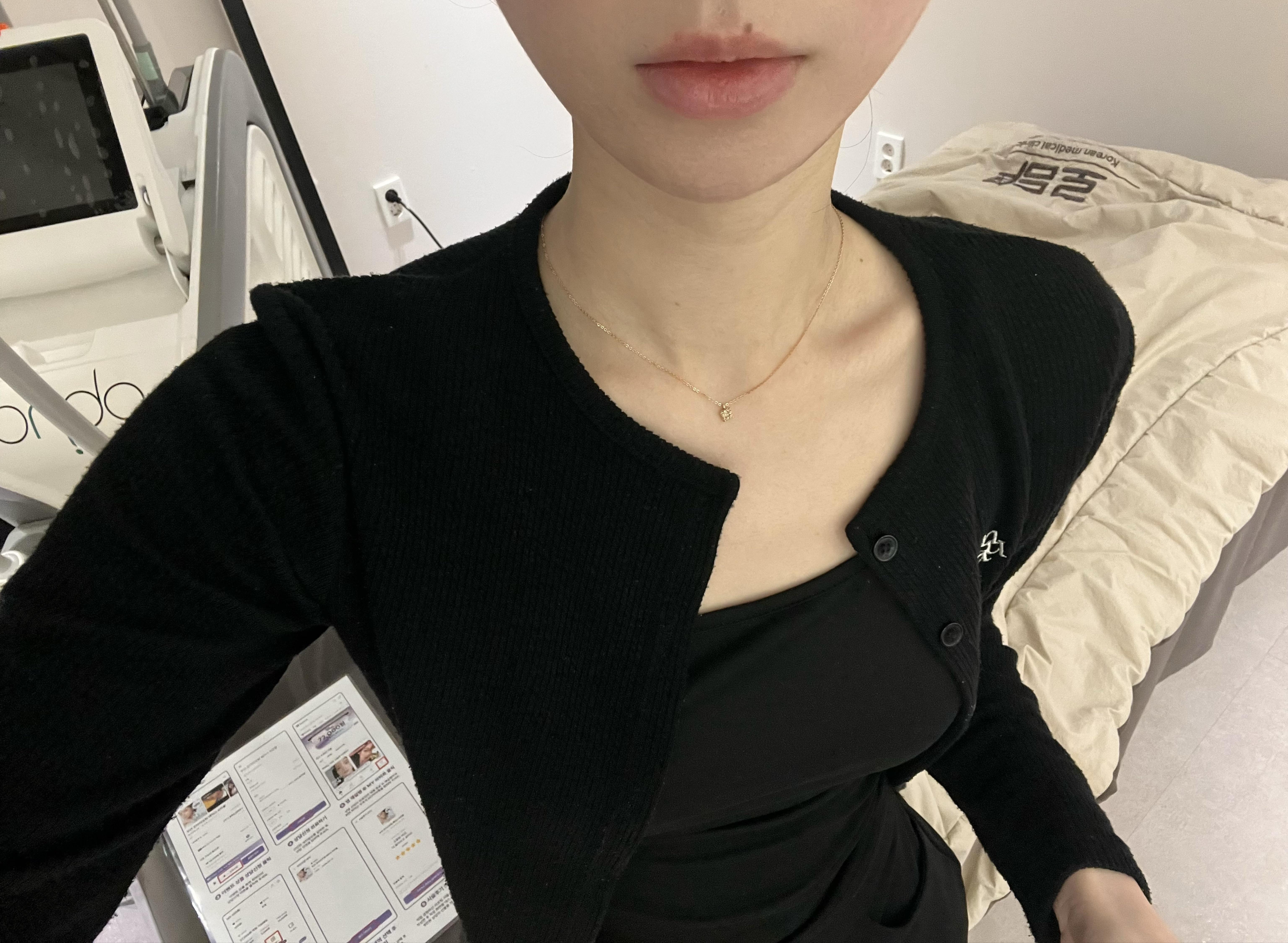 後