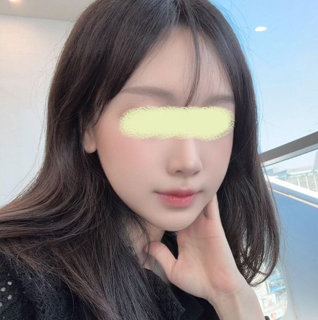 後