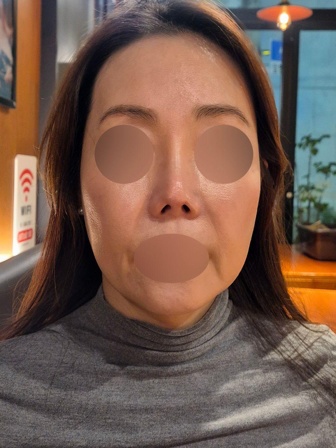 後