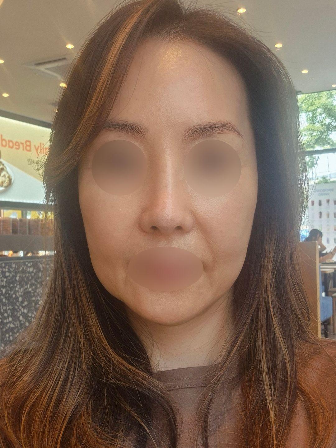 後