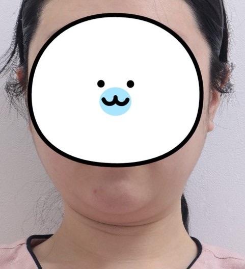 後
