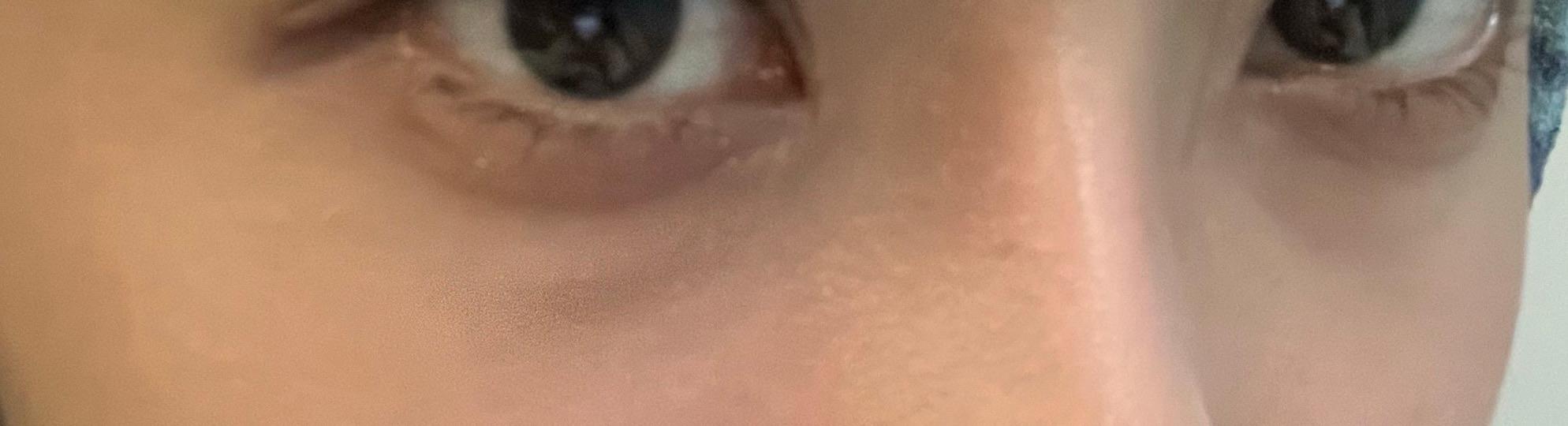前